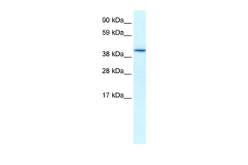 HIF1AN Rabbit Polyclonal Antibody