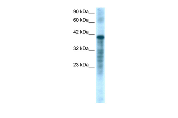 PSMC3 Rabbit Polyclonal Antibody
