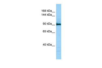 JMJD2C Rabbit Polyclonal Antibody