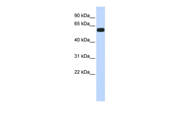 HIC2 Rabbit Polyclonal Antibody