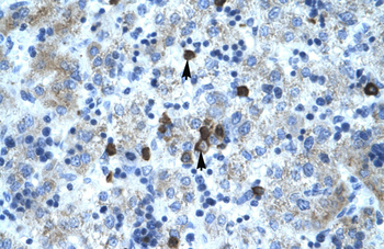 PCYOX1 Rabbit Polyclonal Antibody