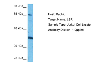 LSR Rabbit Polyclonal Antibody