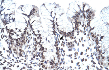 PHF1 Rabbit Polyclonal Antibody