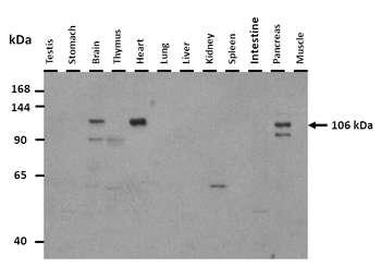 PLD2 Rabbit Polyclonal Antibody