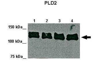 PLD2 Rabbit Polyclonal Antibody