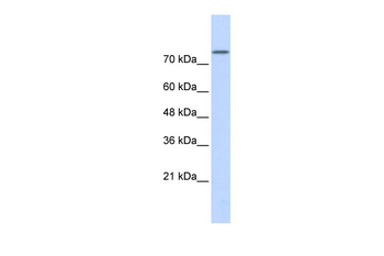 PLD2 Rabbit Polyclonal Antibody