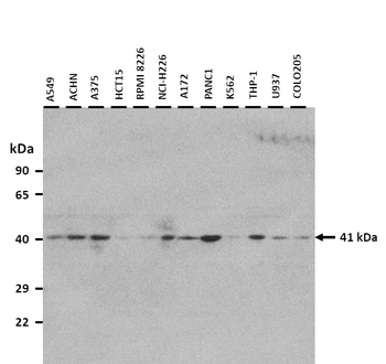 SOX18 Rabbit Polyclonal Antibody