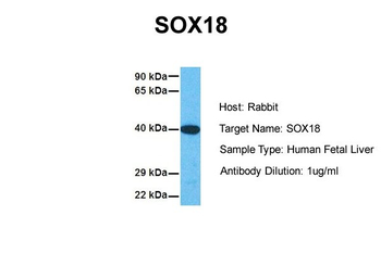 SOX18 Rabbit Polyclonal Antibody