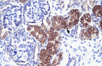 SOX18 Rabbit Polyclonal Antibody