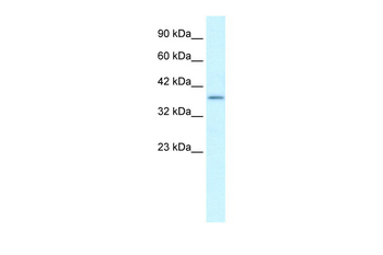 SOX18 Rabbit Polyclonal Antibody