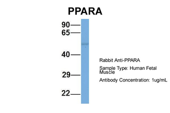 PPARA Rabbit Polyclonal Antibody