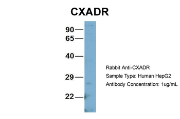 CXADR Rabbit Polyclonal Antibody