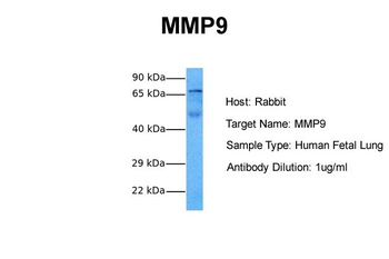 MMP9 Rabbit Polyclonal Antibody