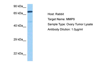 MMP9 Rabbit Polyclonal Antibody