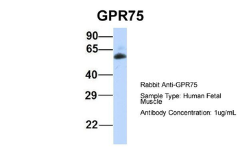 GPR75 Rabbit Polyclonal Antibody