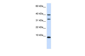 DBI Rabbit Polyclonal Antibody