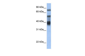 ZNF395 Rabbit Polyclonal Antibody