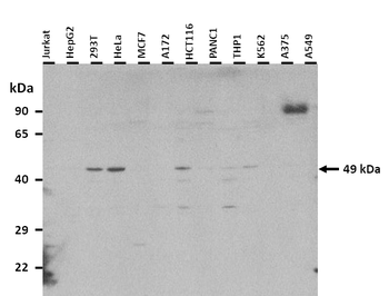 TBX20 Rabbit Polyclonal Antibody