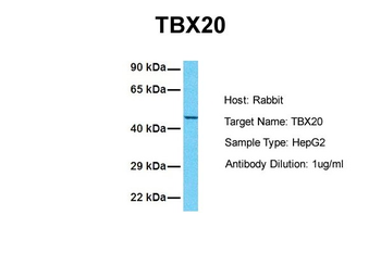 TBX20 Rabbit Polyclonal Antibody