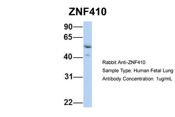 ZNF410 Rabbit Polyclonal Antibody