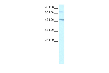 SEMA4A Rabbit Polyclonal Antibody