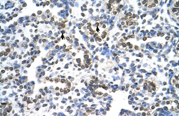 MRPS15 Rabbit Polyclonal Antibody