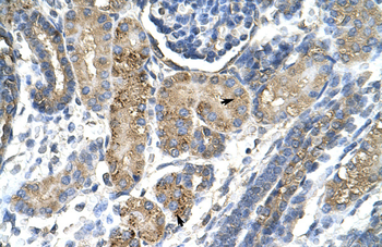 SNAI2 Rabbit Polyclonal Antibody