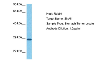SNAI1 Rabbit Polyclonal Antibody