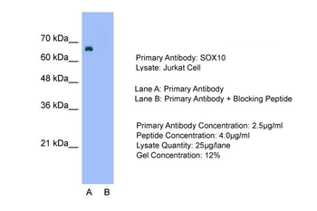 SOX10 Rabbit Polyclonal Antibody