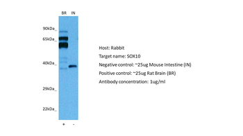 SOX10 Rabbit Polyclonal Antibody