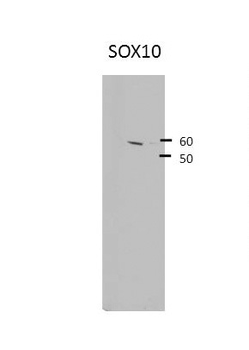 SOX10 Rabbit Polyclonal Antibody