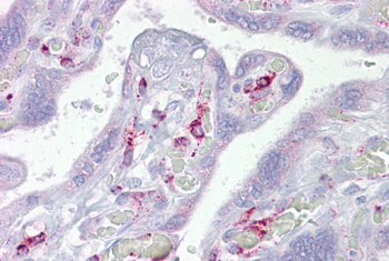 ING3 Rabbit Polyclonal Antibody