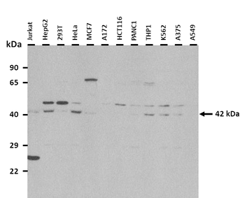 SSTR4 Rabbit Polyclonal Antibody