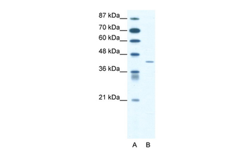 SSTR4 Rabbit Polyclonal Antibody