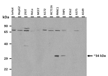 CCND1 Rabbit Polyclonal Antibody