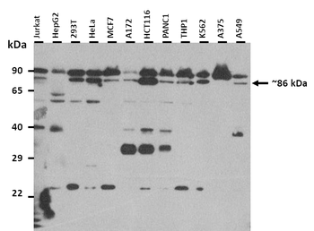 STAT4 Rabbit Polyclonal Antibody
