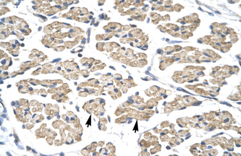 STAT4 Rabbit Polyclonal Antibody
