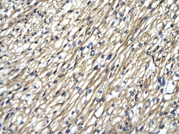 STAT4 Rabbit Polyclonal Antibody