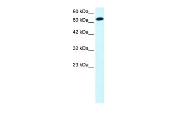 STAT4 Rabbit Polyclonal Antibody