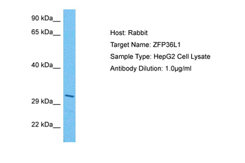 ZFP36L1 Rabbit Polyclonal Antibody