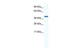 ZFP36L1 Rabbit Polyclonal Antibody