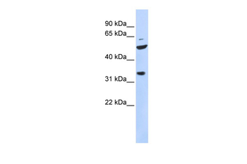 ZFP36L2 Rabbit Polyclonal Antibody