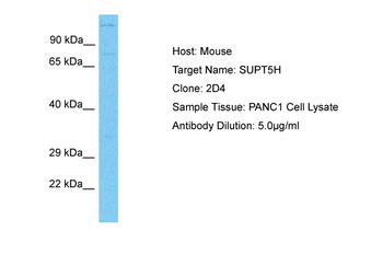 SUPT5H Rabbit Polyclonal Antibody