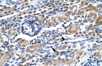 SUPT5H Rabbit Polyclonal Antibody