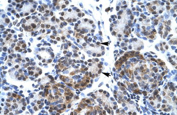 SUPT5H Rabbit Polyclonal Antibody