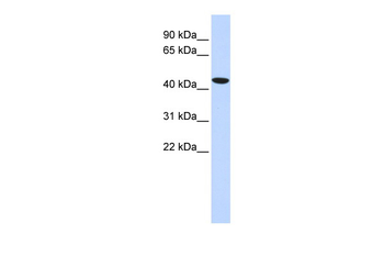 TBX1 Rabbit Polyclonal Antibody