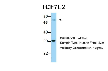 TCF7L2 Rabbit Polyclonal Antibody