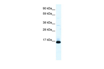 TCF21 Rabbit Polyclonal Antibody