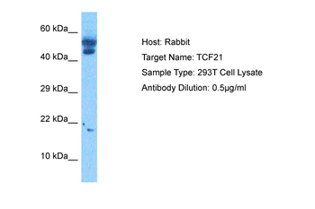TCF21 Rabbit Polyclonal Antibody
