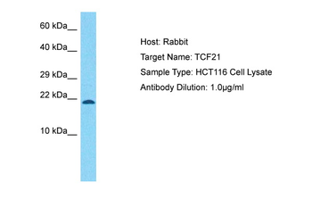 TCF21 Rabbit Polyclonal Antibody